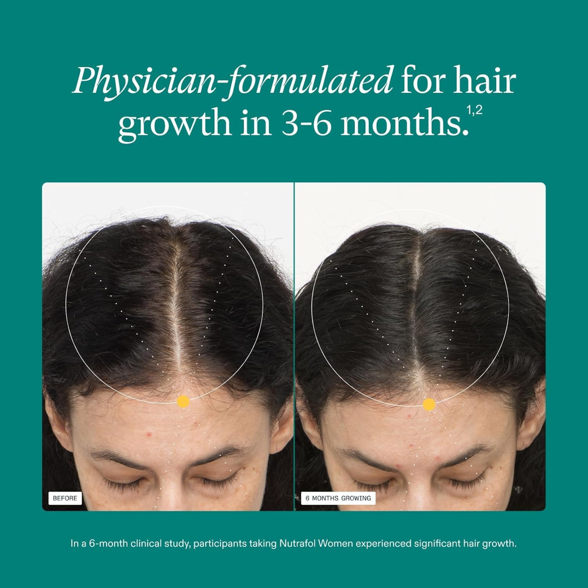 Nutrafol Women Hair Growth Nutraceutical